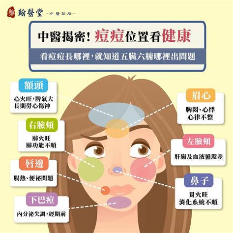 眉上痘痘|眉毛、人中長痘痘的原因？10個「青春痘位置」對應你。